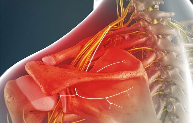 Đau dây thần kinh bả vai và cách massage giảm đau