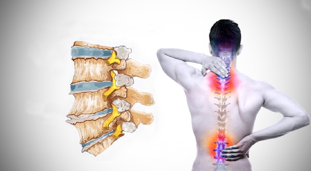 Hướng dẫn cách massage cho người thoái hóa cột sống